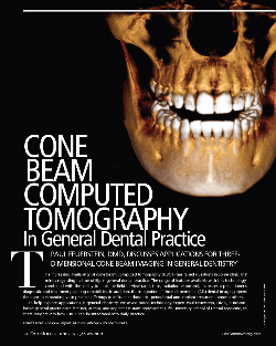 Feature design for Decisions magazine, on Cone Beam Computed Tomography (CBCT) in dental practice.